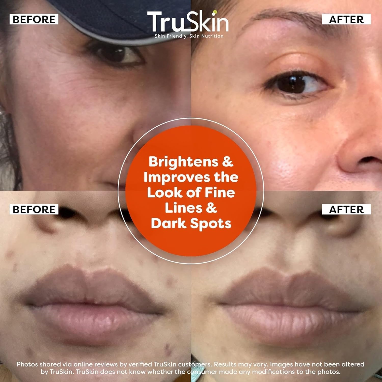 TruSkin Vitamin C Face Serum with Hyaluronic Acid & Vitamin E – Brightening & Anti-Aging