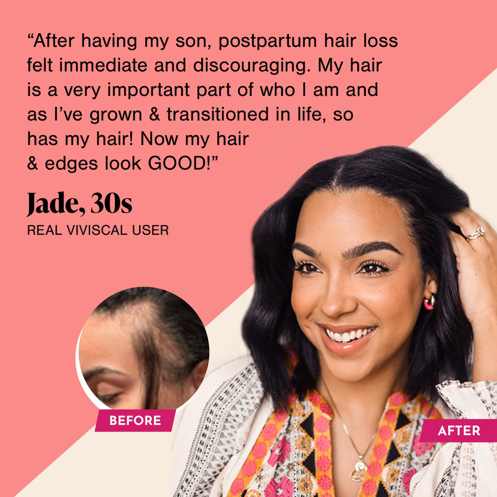 Viviscal Hair Growth Supplements For Women For Thicker, Fuller Hair 180 Tablet