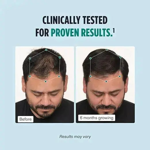 Nutrafol Men's Hair Growth Supplements Pack of 3, Clinically Tested for Visibly Thicker Hair and Scalp Coverage, Dermatologist Recommended - 1 Month - Jia Sales